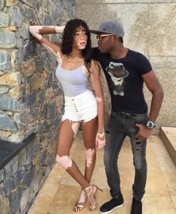 Winnie Harlow is in T&T. She captioned this pic "PAWTY DONE" in IG. 